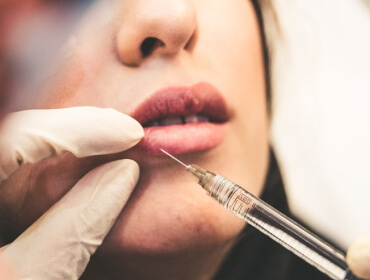 Botox & Fillers: Difference?